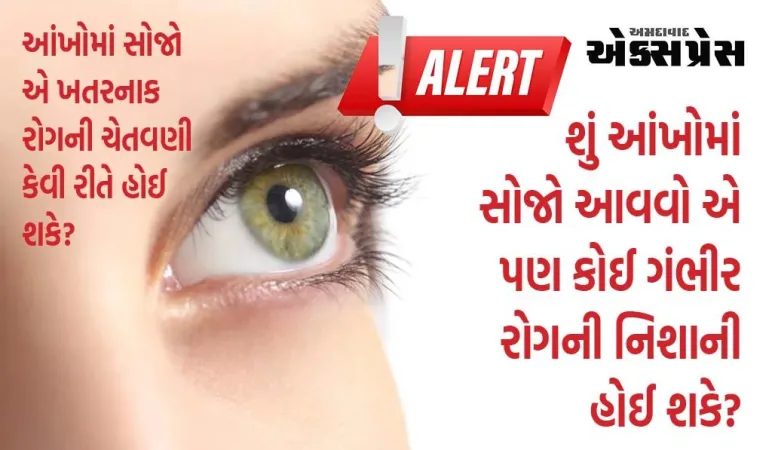 મહિલાએ આંખમાં સોજાની અવગણના કરી, જ્યારે ડોક્ટરે તપાસ કરી તો બહાર આવ્યું 'ભયંકર રોગ'