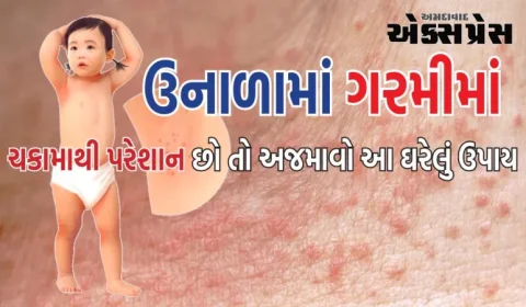 જો તમે ઉનાળામાં ગરમીના ચકામાથી પરેશાન છો તો આ ઘરેલું ઉપાય અજમાવો, તમને તરત જ રાહત મળશે