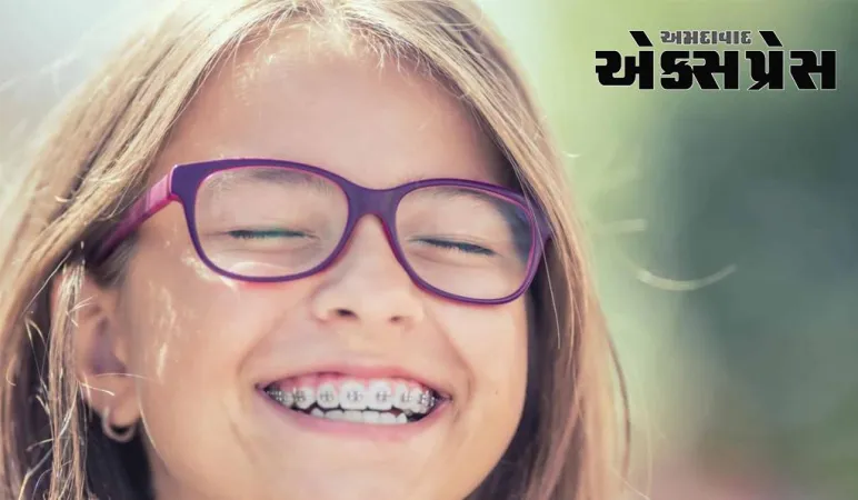 શું દાંતને તાર લગાવવાથી ચહેરાનો દેખાવ બદલાઈ જાય છે?