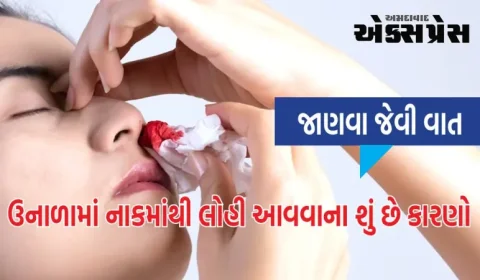 ઉનાળામાં નાકમાંથી લોહી આવવાના શું કારણો છે તેનાથી કેવી રીતે બચી શકાય ડોક્ટર પાસેથી જાણો