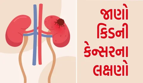 કિડની કેન્સરના પ્રારંભિક તબક્કામાં દેખાય છે આ 5 લક્ષણો, જાણો કારણો અને સારવાર