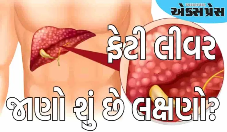 ફેટી લીવરના શરૂઆતના લક્ષણો શું છે?