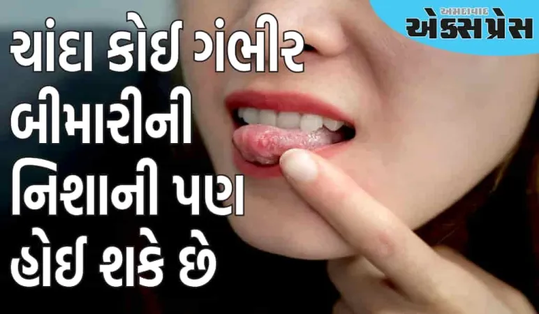ઉનાળામાં વારંવાર મોઢામાં ચાંદા પડવા એ કયા રોગનું લક્ષણ છે?