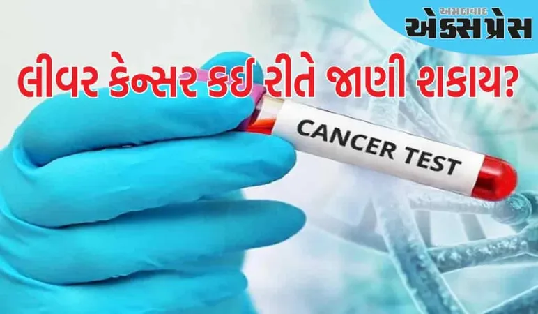 લીવર કેન્સરના શરૂઆતના લક્ષણો શું છે? તેને કેવી રીતે જાણી શકાય?