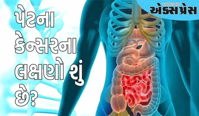 પેટના કેન્સરના સૌથી મોટા લક્ષણો શું છે? કેવી રીતે ઓળખવું
