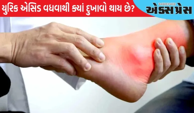 જ્યારે યુરિક એસિડનું સ્તર વધે છે, ત્યારે શરીરના આ ભાગોમાં તીવ્ર દુખાવો થાય છે, ભૂલથી પણ તેને અવગણશો નહીં