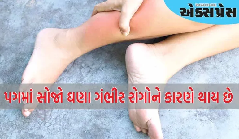 કયા રોગથી પગમાં સોજો આવે છે?