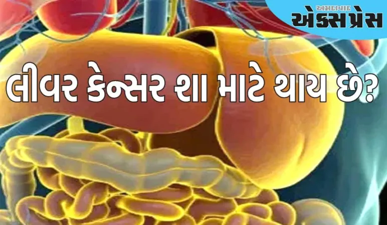 લીવર કેન્સર શા માટે થાય છે? કેવી રીતે કરી શકાય બચાવ?