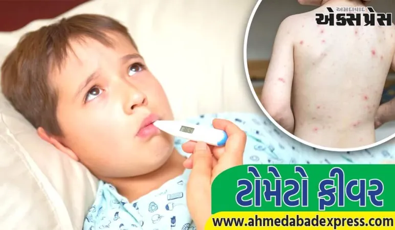 Tomato Fever: ટોમેટો ફીવર શું છે, તે કેવી રીતે ફેલાય છે, તે બાળકો માટે કેમ ખતરનાક છે?