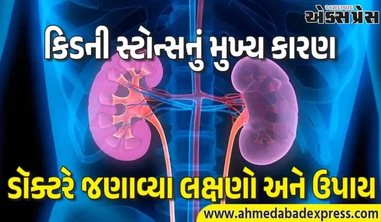 ઓછું પાણી પીવાની આદત કિડની સ્ટોનનો ખતરો વધારે છે – લક્ષણો અને નિવારણ જાણો