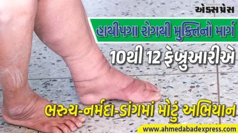 હાથીપગા રોગને હરાવવા મોટું અભિયાન! 10-12 ફેબ્રુઆરીએ 5.48 લાખ લોકોને મફત દવા, ભરુચ-નર્મદા-ડાંગમાં શરૂ