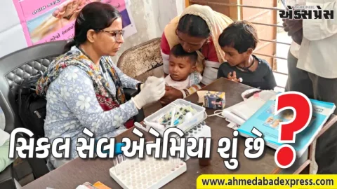 સિકલ સેલ મુક્ત ગુજરાત: 1.11 કરોડથી વધુ લોકોનું સ્ક્રીનિંગ કરી રાજ્યે રચ્યો ઇતિહાસ