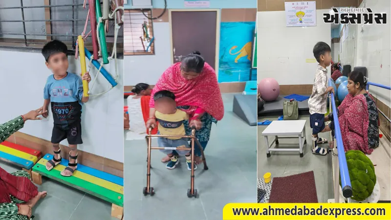 એસ.એસ.જી. હોસ્પિટલના DEIC ફિઝિયોથેરાપી વિભાગની મોટી સફળતા