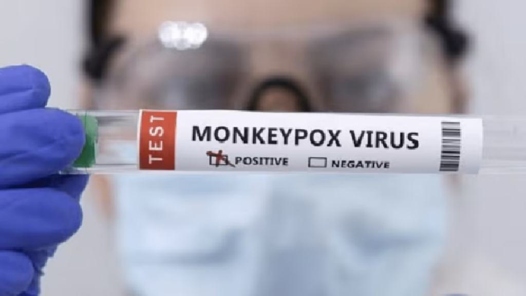 Monkeypox Alert: ભારતમાં શંકાસ્પદ મંકીપોક્સ કેસ નોંધાયો, દર્દી હાલત સ્થિર