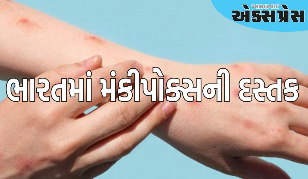 ભારતમાં મંકીપોક્સનો પહેલો કેસ જોવા મળ્યો, દર્દીને એક દિવસ પહેલા દિલ્હીમાં અલગ રાખવામાં આવ્યો હતો