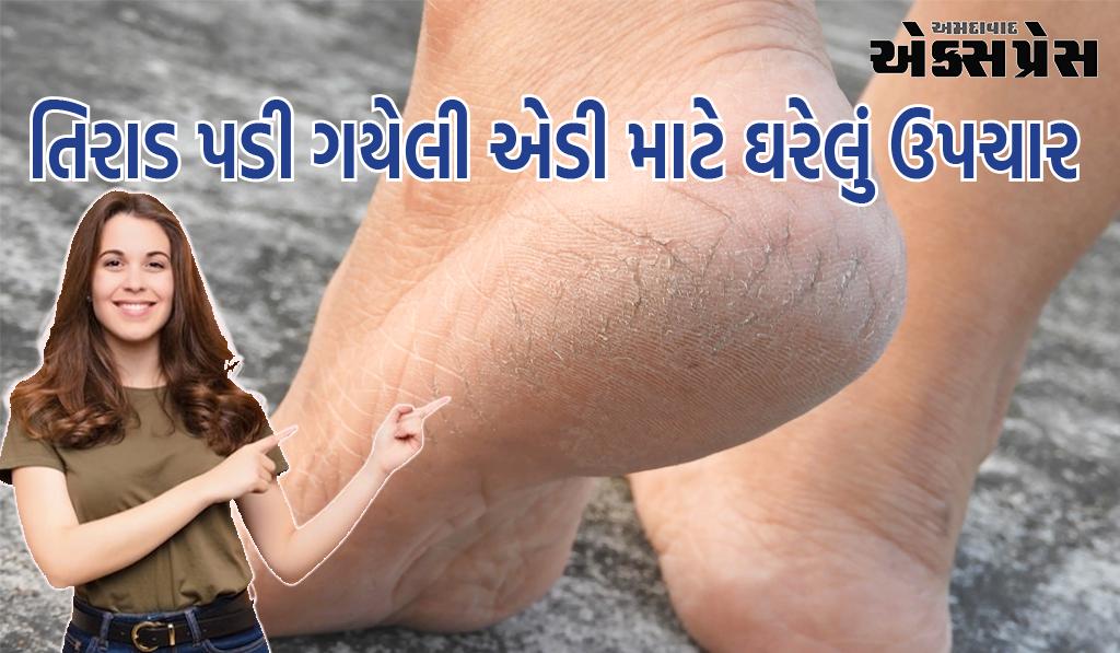 એક અઠવાડિયામાં આ 2 વસ્તુઓની મદદથી તિરાડ પડી ગયેલી એડીની સારવાર કરો, તમારા પગ તમારા ચહેરા જેવા જ સુંદર દેખાશે